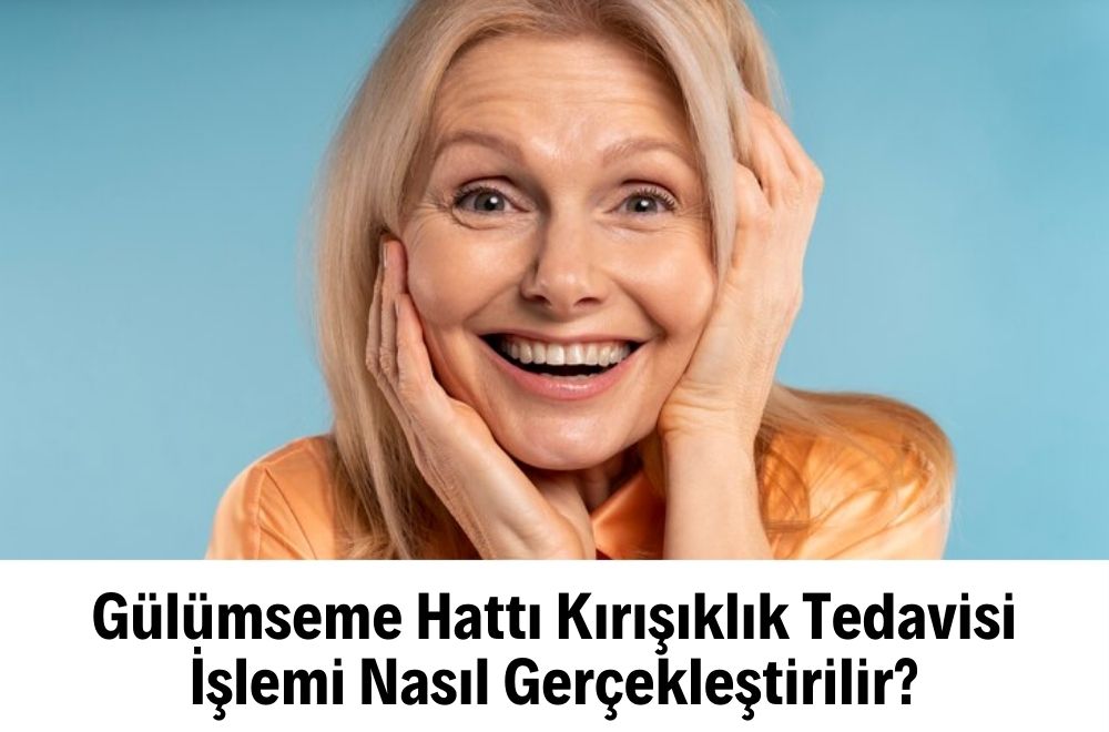 Gülümseme Hattı Kırışıklık Tedavisi