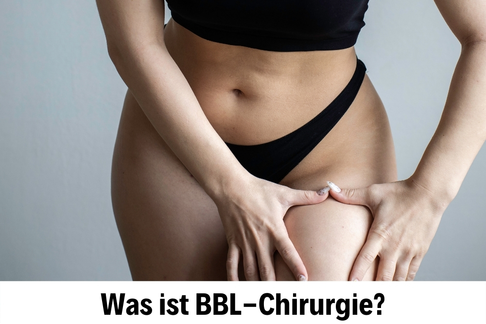 BBL-Chirurgie