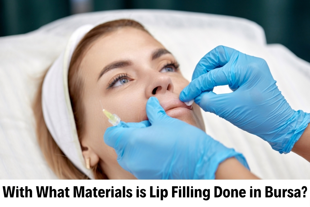 Lip Filling