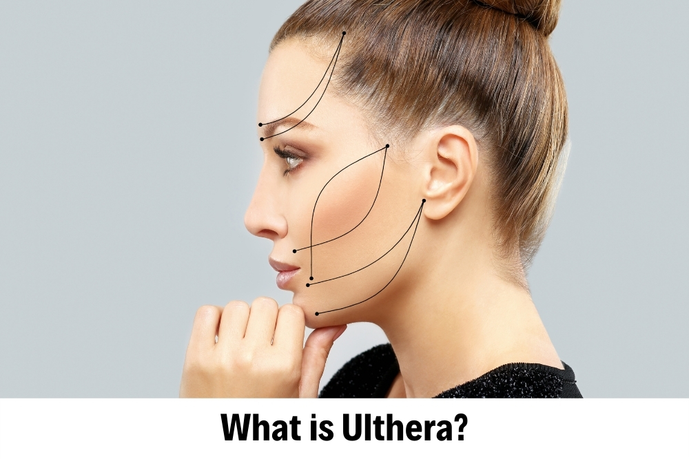 Ulthera 