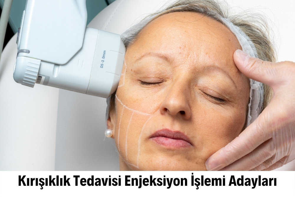 Kırışıklık Tedavisi 