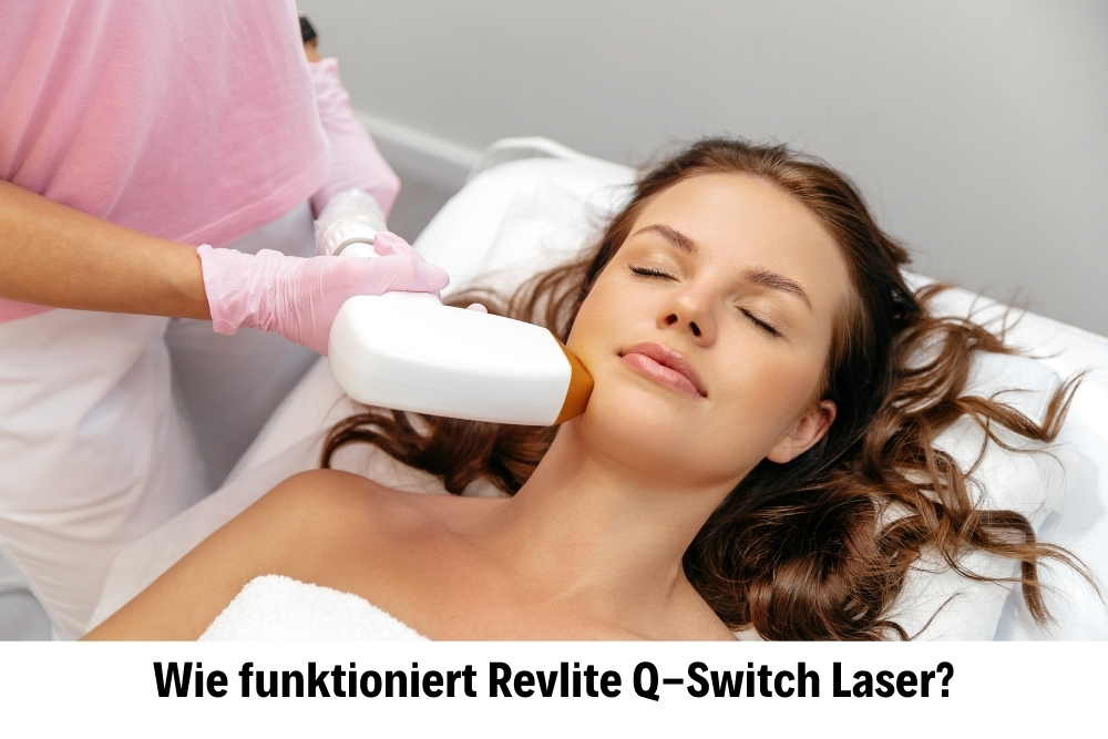 Revite Q Switch Laser