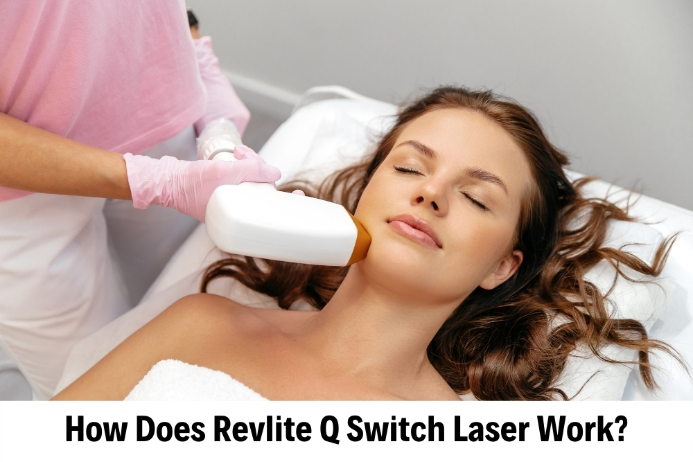 Revite Q Switch Laser