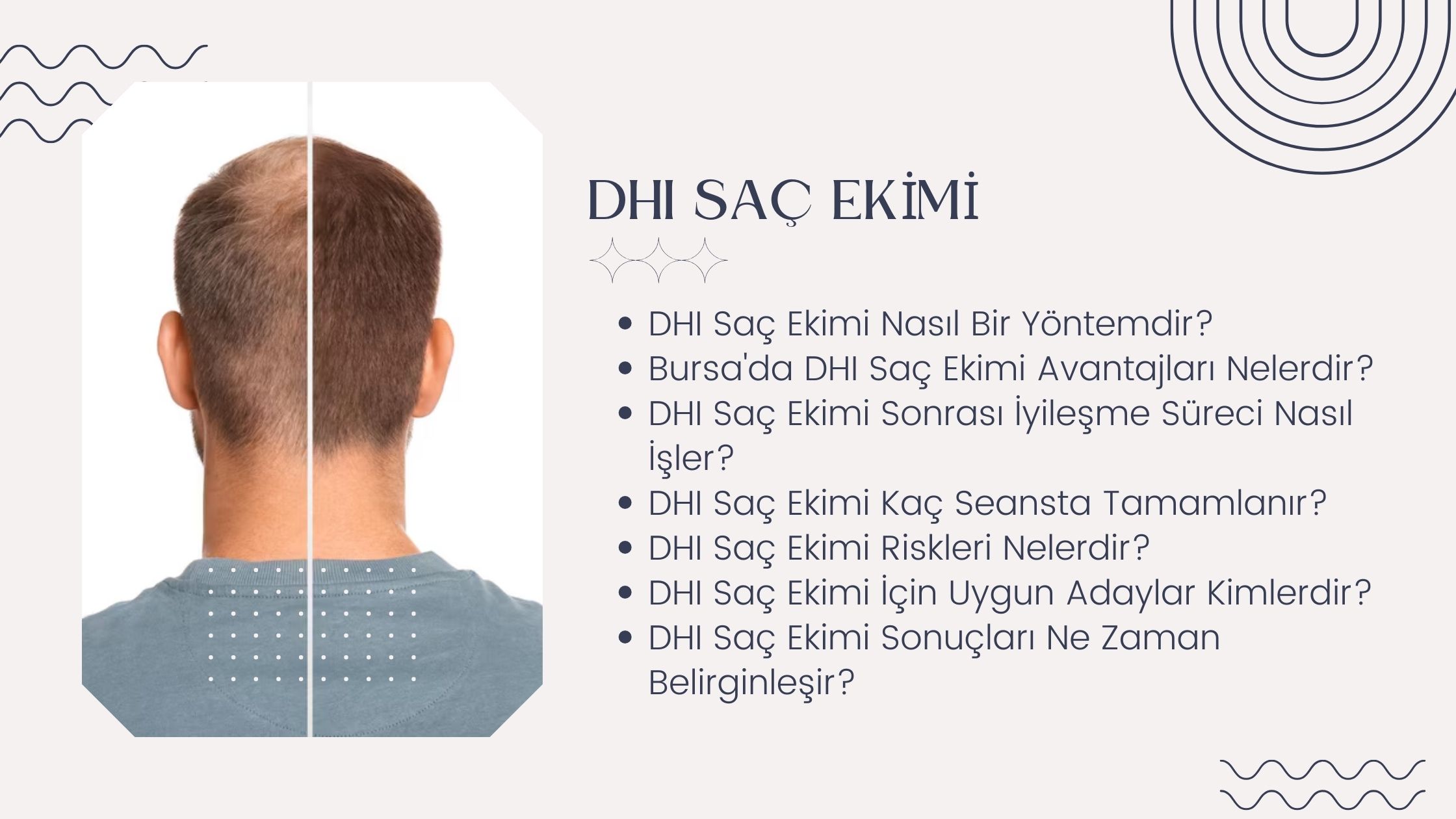 DHI Saç Ekimi