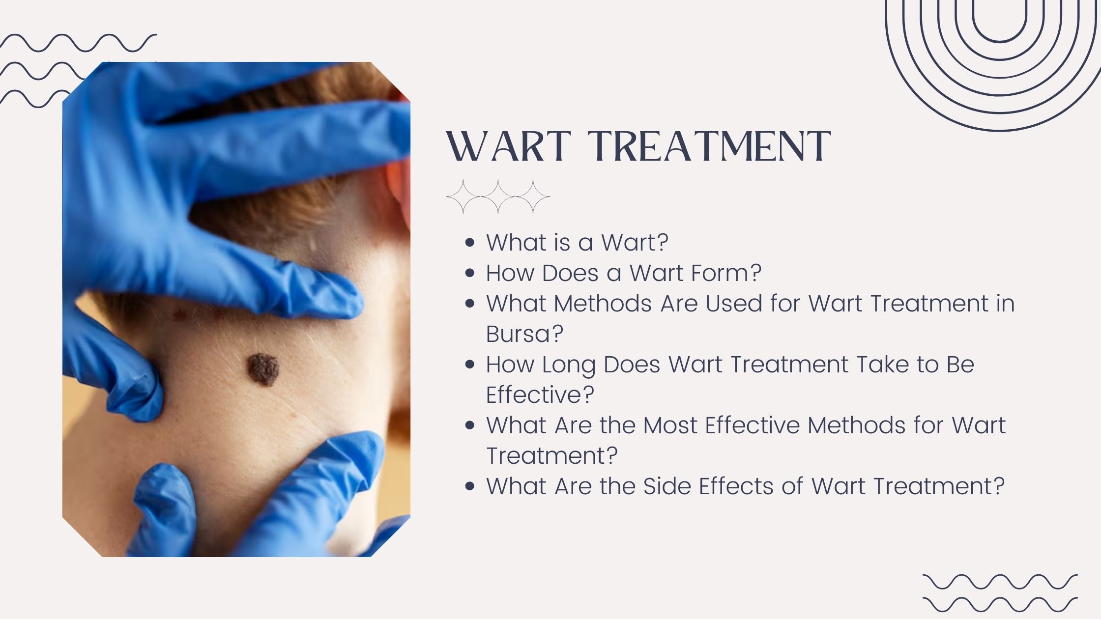 Wart Treatment