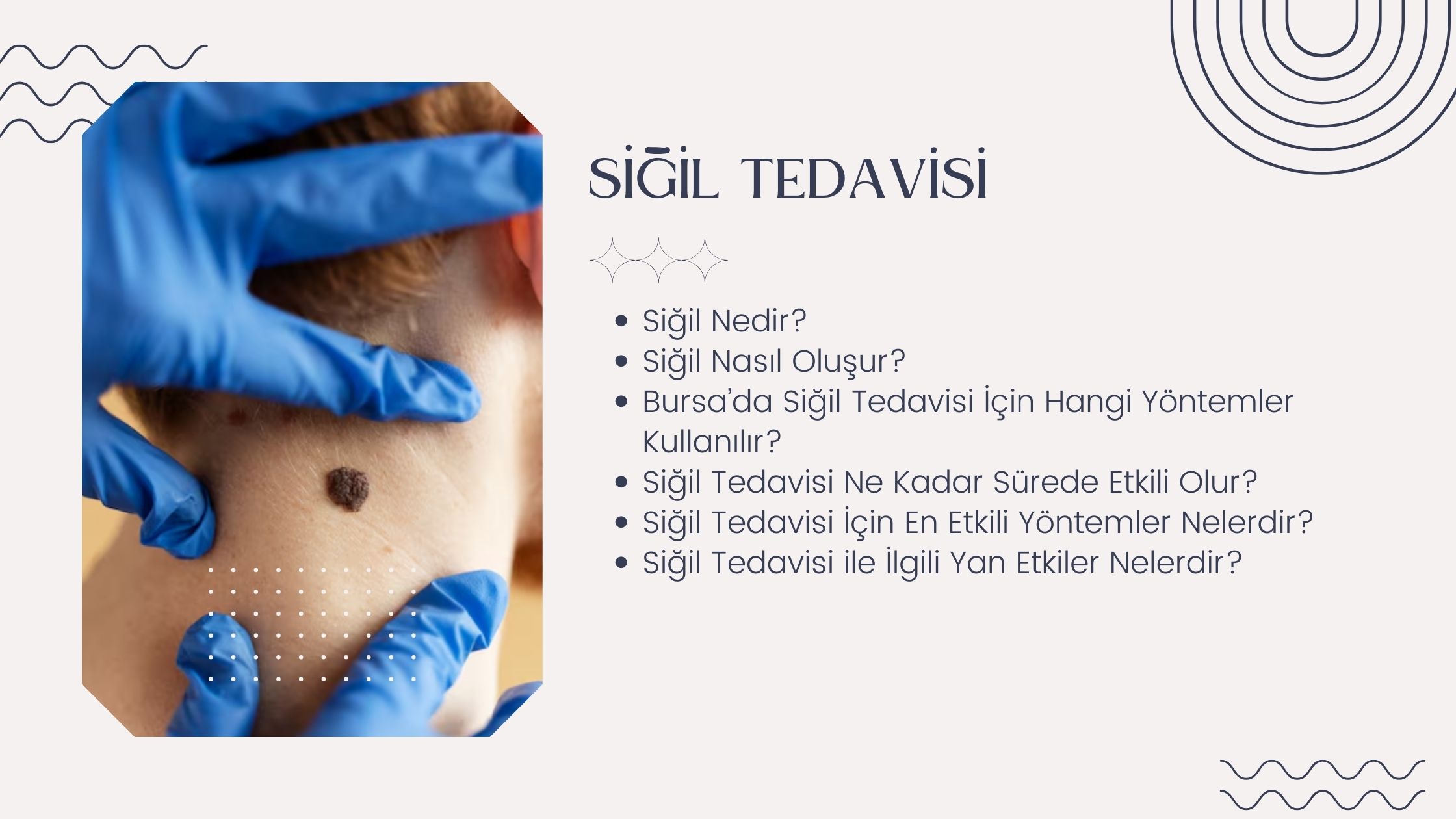 Siğil Tedavisi