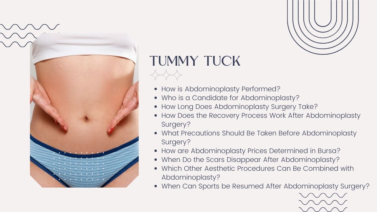 Abdominoplasty