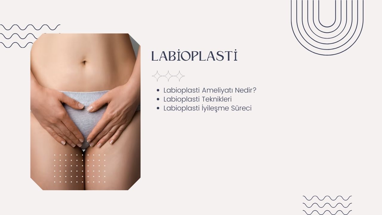 Labioplasti