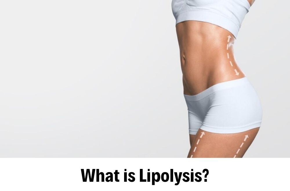 Lipolysis