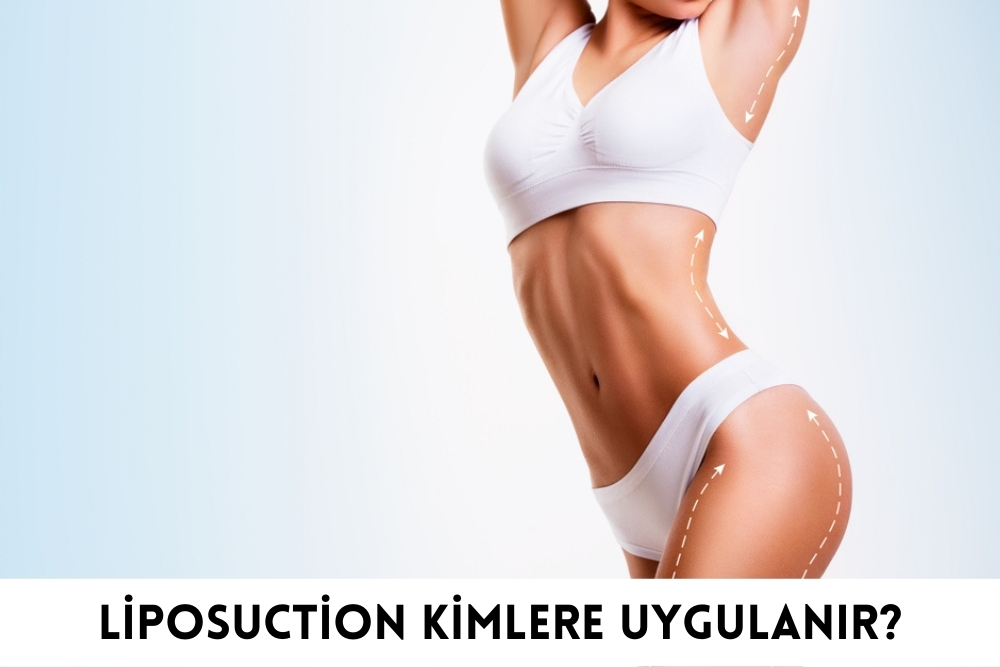 liposuction