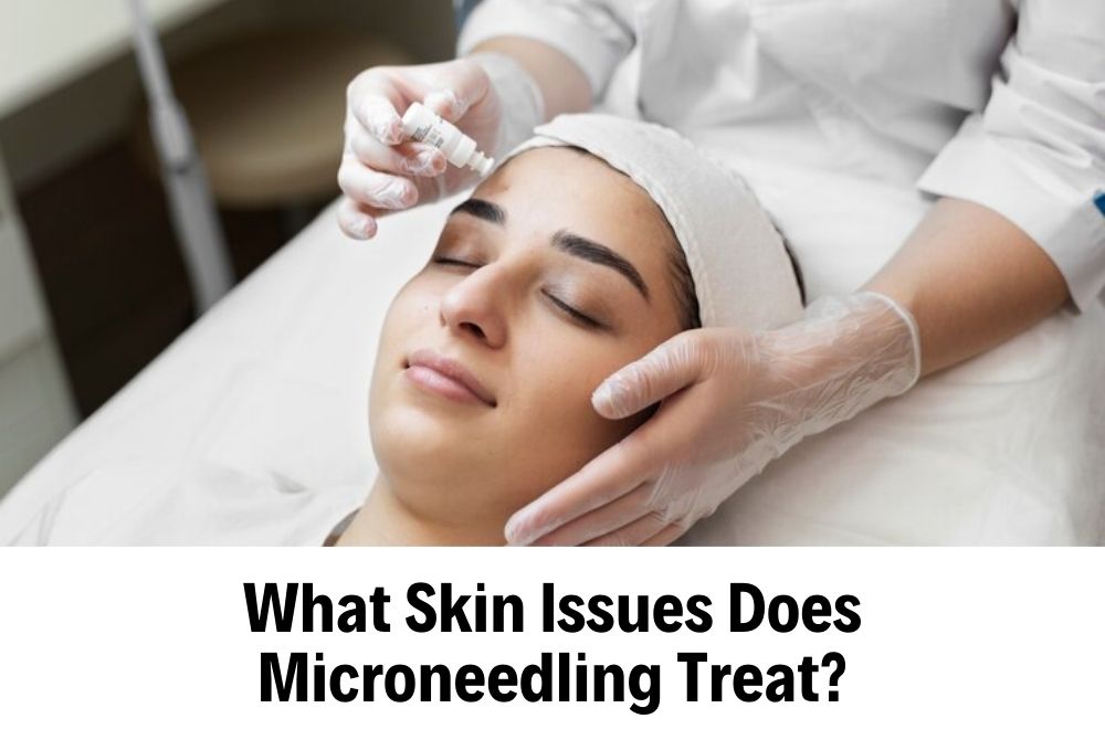 Microneedling