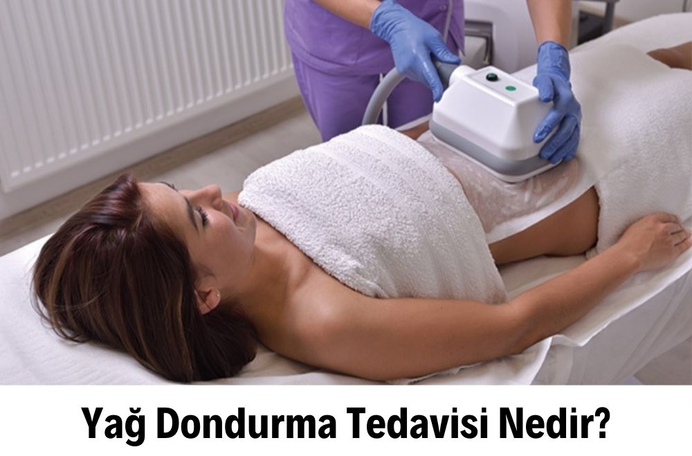 Yağ Dondurma