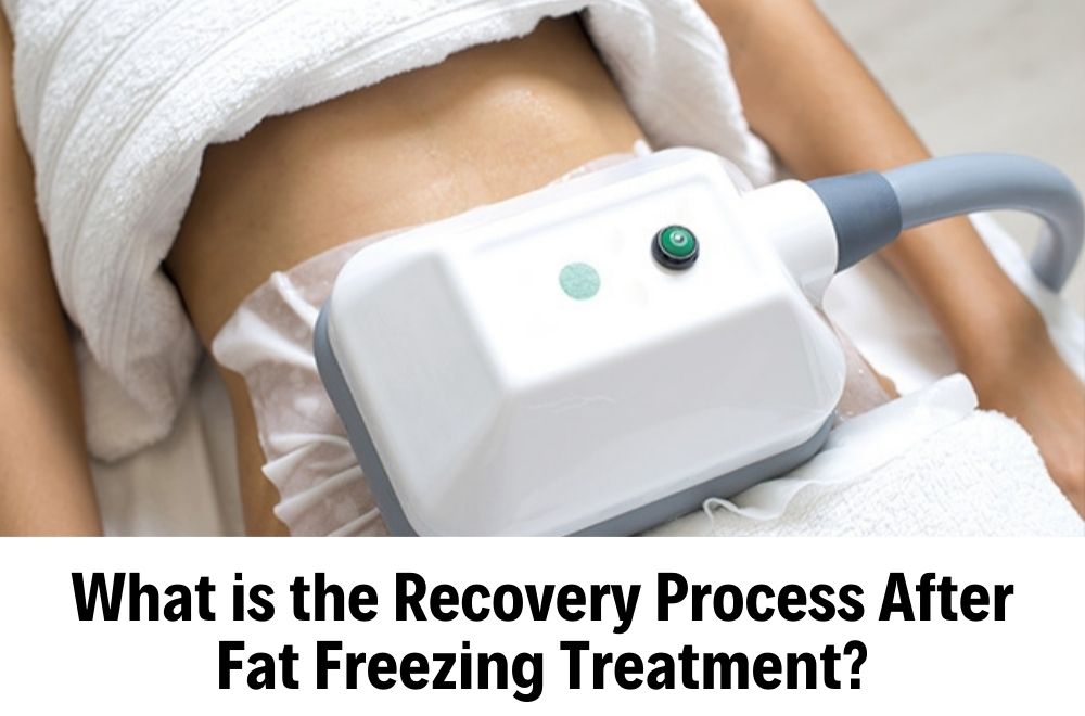 Fat Freezing