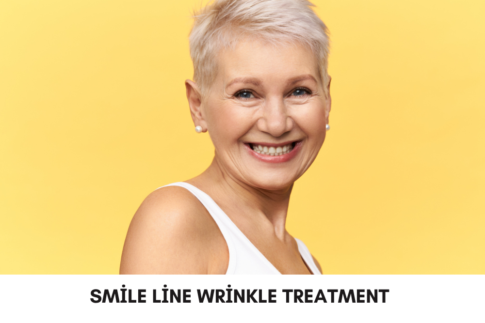 Smile Line Wrinkle Treatment