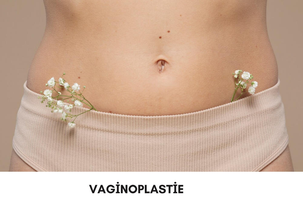 Vaginoplastie