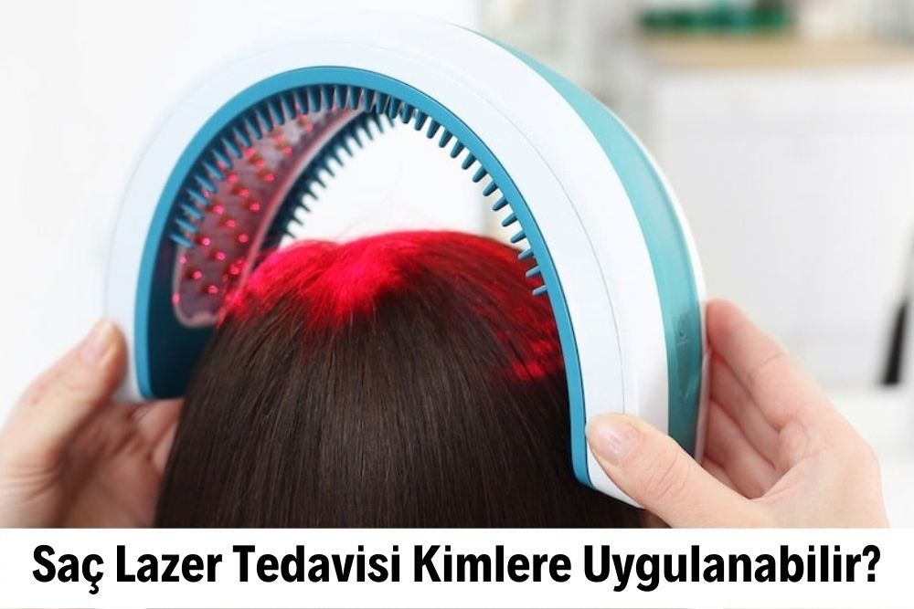 Saç Lazer Tedavisi