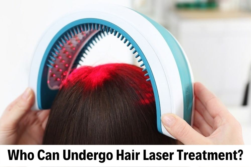 hair laser treatment