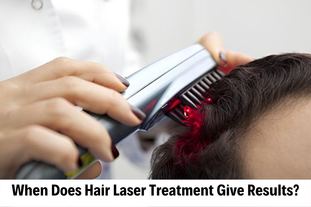 hair laser treatment